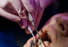 Straightening Smiles Made Simple: A Guide to Professional Dental Alignment